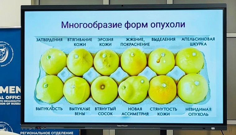 Тюменские союзницы на страже здоровья